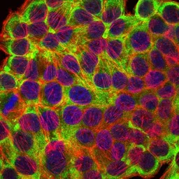 Anti-Cytokeratin 19 antibody [4E8] used in Immunocytochemistry/ Immunofluorescence (ICC/IF). GTX60480