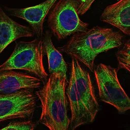 Anti-CBL antibody [3B12] used in Immunocytochemistry/ Immunofluorescence (ICC/IF). GTX60481