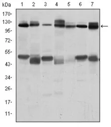Anti-CBL antibody [3B12] used in Western Blot (WB). GTX60481