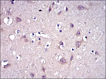 Anti-MMP9 antibody [5G3] used in IHC (Paraffin sections) (IHC-P). GTX60482