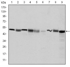 Anti-TCP1 beta antibody [5B5F5] used in Western Blot (WB). GTX60497