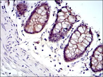 Anti-gamma Catenin antibody [4C12] used in IHC (Paraffin sections) (IHC-P). GTX60501