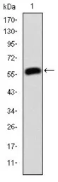 Anti-gamma Catenin antibody [4C12] used in Western Blot (WB). GTX60501