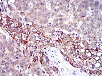 Anti-Fibrinogen gamma antibody [4H9] used in IHC (Paraffin sections) (IHC-P). GTX60502