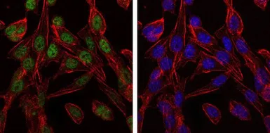 Anti-TCP1 beta antibody [5B5C4] used in Immunocytochemistry/ Immunofluorescence (ICC/IF). GTX60505