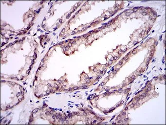 Anti-UBE2I antibody [1B10] used in IHC (Paraffin sections) (IHC-P). GTX60512