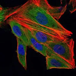 Anti-IL1 beta antibody [3A6] used in Immunocytochemistry/ Immunofluorescence (ICC/IF). GTX60513