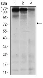 Anti-MSH6 antibody [5B11] used in Western Blot (WB). GTX60514