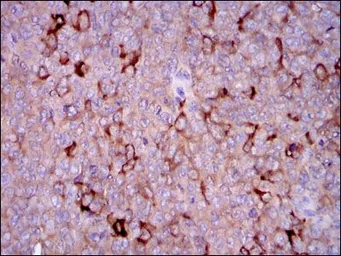 Anti-G6PD antibody [5E12] used in IHC (Paraffin sections) (IHC-P). GTX60515