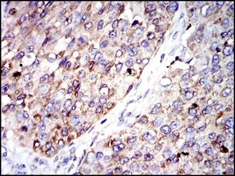 Anti-G6PD antibody [2H7] used in IHC (Paraffin sections) (IHC-P). GTX60518