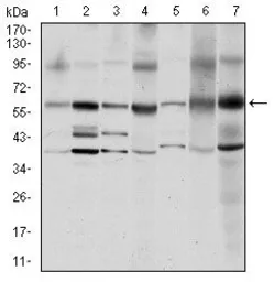 Anti-Src antibody [1F11] used in Western Blot (WB). GTX60521