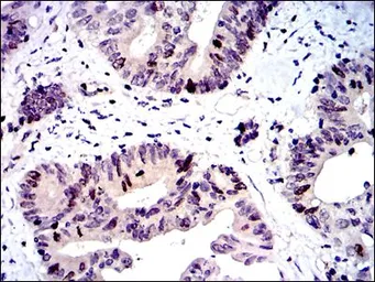 Anti-Survivin antibody [1H5] used in IHC (Paraffin sections) (IHC-P). GTX60534