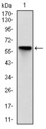 Anti-ROCK1 antibody [1H4] used in Western Blot (WB). GTX60535