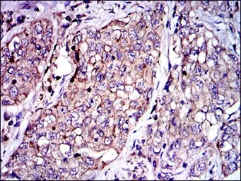 Anti-PAI-1 antibody [1D5] used in IHC (Paraffin sections) (IHC-P). GTX60537