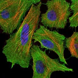 Anti-Fas antibody [4F8H6] used in Immunocytochemistry/ Immunofluorescence (ICC/IF). GTX60557