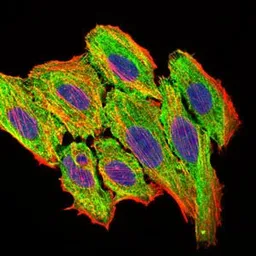 Anti-MCP1 / CCL2 antibody [2D8] used in Immunocytochemistry/ Immunofluorescence (ICC/IF). GTX60582