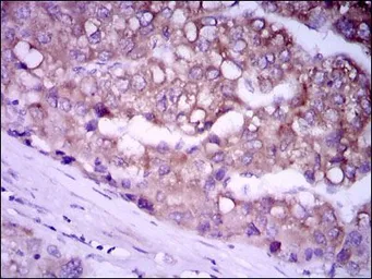 Anti-Glypican-3 antibody [9C2] used in IHC (Paraffin sections) (IHC-P). GTX60603