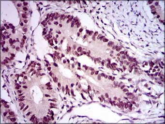 Anti-E2F1 antibody [8G9] used in IHC (Paraffin sections) (IHC-P). GTX60615