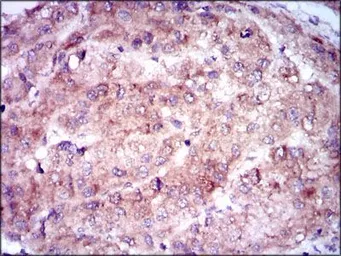 Anti-NSE antibody [5D3] used in IHC (Paraffin sections) (IHC-P). GTX60625