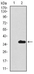 Anti-Uteroglobin antibody [3A8B8] used in Western Blot (WB). GTX60655