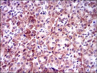 Anti-PSAP antibody [4D5F4] used in IHC (Paraffin sections) (IHC-P). GTX60673