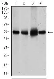 Anti-GLUT4 antibody [3G10A3] used in Western Blot (WB). GTX60674