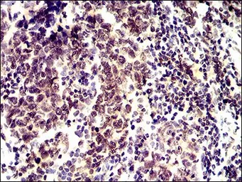 Anti-ID2 antibody [4E12G5] used in IHC (Paraffin sections) (IHC-P). GTX60689