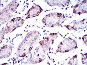 Anti-SLC27A5 antibody [4B11C10] used in IHC (Paraffin sections) (IHC-P). GTX60693