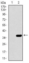 Anti-SLC27A5 antibody [4B11C10] used in Western Blot (WB). GTX60693