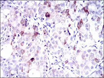 Anti-SLC27A5 antibody [9C4D1] used in IHC (Paraffin sections) (IHC-P). GTX60703