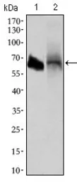Anti-Alkaline phosphatase (intestinal) antibody [3B10E7] used in Western Blot (WB). GTX60746