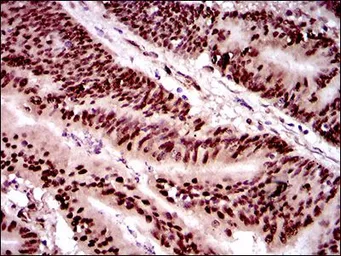 Anti-Twist1 antibody [10E4E6] used in IHC (Paraffin sections) (IHC-P). GTX60776