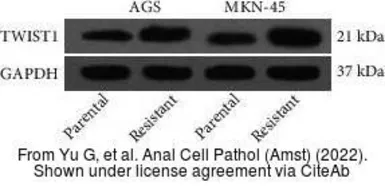 Anti-Twist1 antibody [10E4E6] used in Western Blot (WB). GTX60776