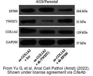 Anti-Twist1 antibody [10E4E6] used in Western Blot (WB). GTX60776