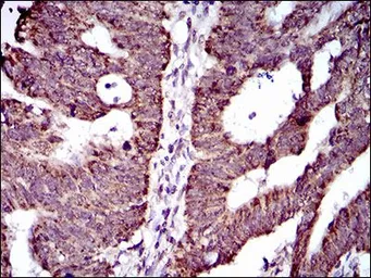 Anti-ABCG5 antibody [1B5E10] used in IHC (Paraffin sections) (IHC-P). GTX60788