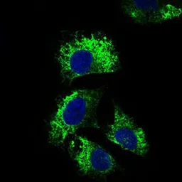 Anti-IL2 Receptor alpha antibody [1B5D12] used in Immunocytochemistry/ Immunofluorescence (ICC/IF). GTX60792