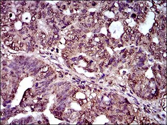 Anti-IL2 Receptor alpha antibody [1B5D12] used in IHC (Paraffin sections) (IHC-P). GTX60792