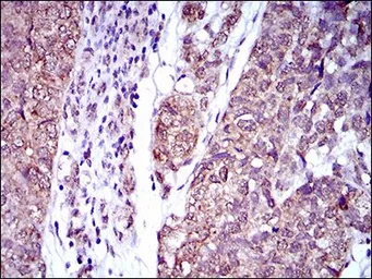 Anti-IL2 Receptor alpha antibody [1B5D12] used in IHC (Paraffin sections) (IHC-P). GTX60792