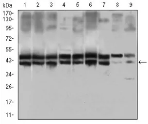 Anti-IL2 Receptor alpha antibody [1B5D12] used in Western Blot (WB). GTX60792