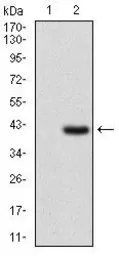 Anti-IL2 Receptor alpha antibody [1B5D12] used in Western Blot (WB). GTX60792