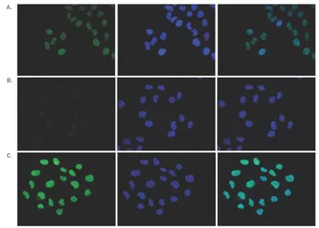 Anti-Histone H2A.Z antibody - ChIP grade used in Immunocytochemistry/ Immunofluorescence (ICC/IF). GTX60812