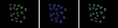 Anti-Histone H2A.Z (acetyl Lys4/Lys7/Lys11) antibody - ChIP grade used in Immunocytochemistry/ Immunofluorescence (ICC/IF). GTX60813