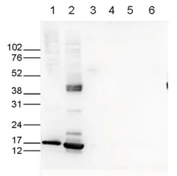 Anti-Histone H3K27ac (Acetyl Lys27) antibody - ChIP grade used in Western Blot (WB). GTX60815
