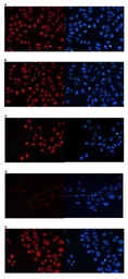 Anti-Histone H3K4me2 (Di-methyl Lys4) antibody - ChIP grade used in Immunocytochemistry/ Immunofluorescence (ICC/IF). GTX60819