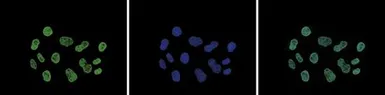 Anti-Histone H3K9K14ac (Acetyl Lys9/Lys14) antibody - ChIP grade used in Immunocytochemistry/ Immunofluorescence (ICC/IF). GTX60822