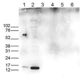 Anti-Histone H3R17me2K18ac (Asymmetric Di-methyl Arg17/Acetyl Lys18) antibody - ChIP grade used in Western Blot (WB). GTX60825