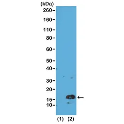 Anti-Histone H3K4me3 (Tri-methyl Lys4) antibody [RM137] used in Western Blot (WB). GTX60876