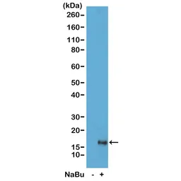 Anti-Histone H3K79ac (Acetyl Lys79) antibody [RM156] used in Western Blot (WB). GTX60883