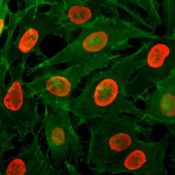 Anti-Histone H3K9ac (Acetyl Lys9) antibody [RM161] used in Immunocytochemistry/ Immunofluorescence (ICC/IF). GTX60885