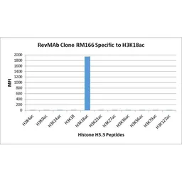 Anti-Histone H3K18ac (Acetyl Lys18) antibody [RM166] used in  (). GTX60886